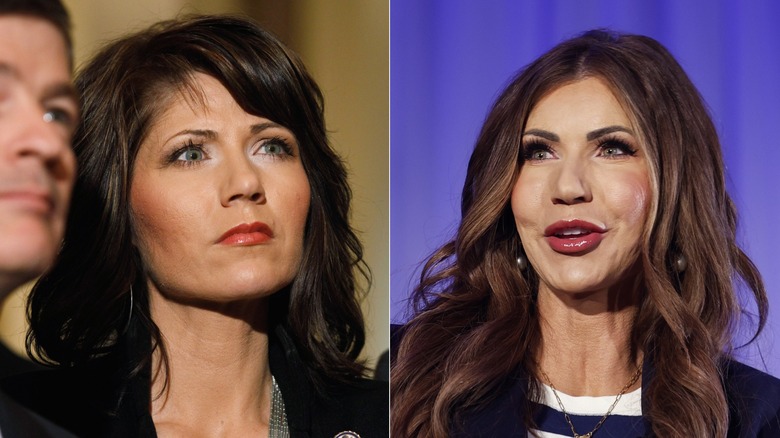 Kristi Noem sur une vieille photo et un plus mis à jour de Noem avec des lèvres plus grandes