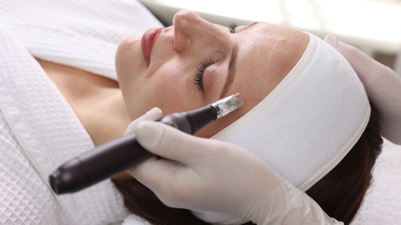 Une jeune femme subit une intervention de microneedling