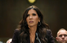 8 photos qui illustrent la transformation bouleversante des lèvres de Kristi Noem