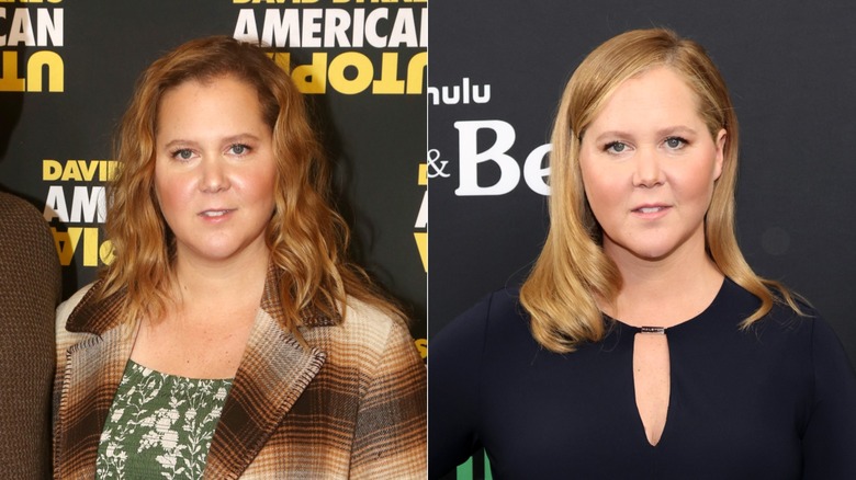 Photos côte à côte d'Amy Schumer avec un visage gonflé en octobre 2021 et un visage plus défini après avoir retiré son produit de comblement en mars 2022