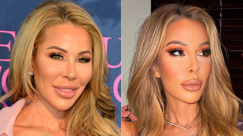 Photos côte à côte de Lisa Hochstein sur le tapis rouge en 2020 et posant en 2023 avec moins de remplissage facial