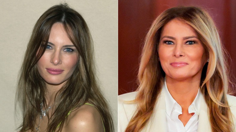 Photos côte à côte de Melania Trump comparant son visage plus jeune à son visage actuel