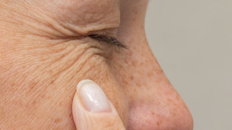 Un gros plan d'un oeil avec des rides et un doigt touchant la peau avec des taches de rousseur
